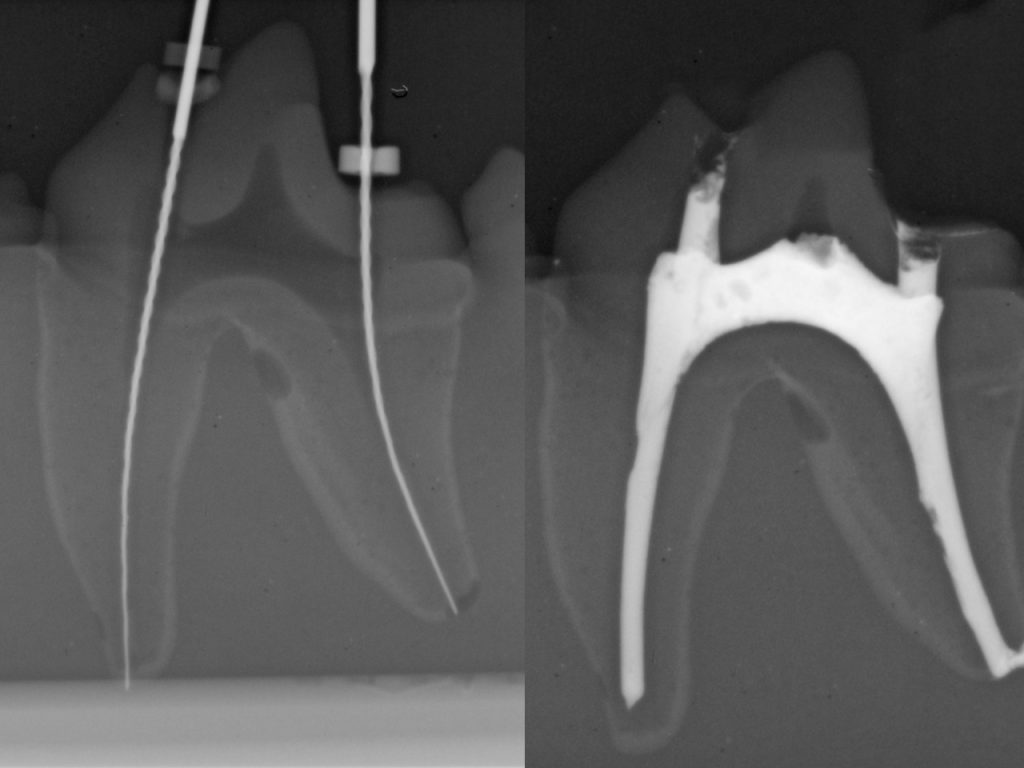 X-Ray